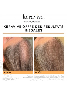 SOIN HYDRAFACIAL KERAVIVE ZONE CIBLEE